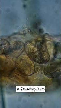 A Tardigrade hatching eggs sorrounded by it's siblings.