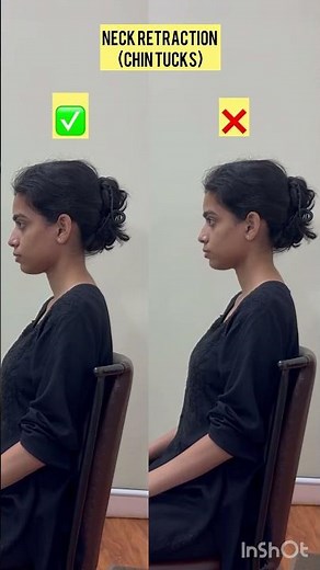 Neck Retraction / chin tucks