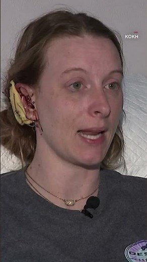 Loose pet monkey attacks woman, ripping 'handfuls of hair' and part of her ear off