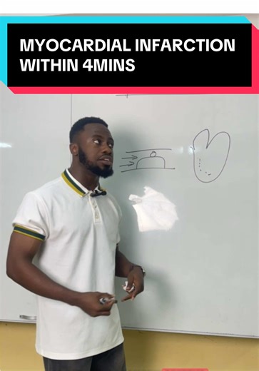 Understanding Myocardial Infarction in 4 Minutes