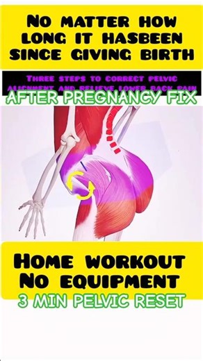 Best Exercise After Delivery to Reduce Belly & Fix Pelvic Alignment #shorts