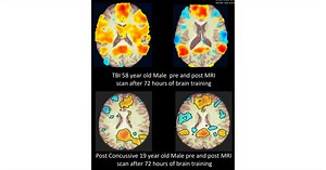 LearningRx Brain Training Reviews the Benefits of Cognitive Baselines for Young Athletes