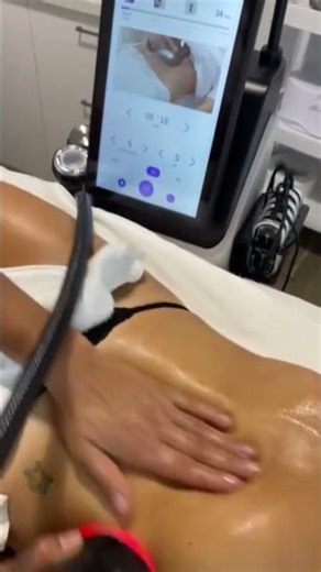 Triple-Transducer Cavitation | Faster Belly Sculpting Results