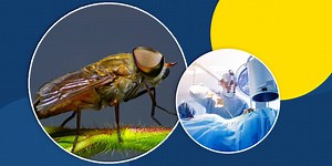 3 Live Botflies Removed From American Woman's Eye In Delhi Hospital, Gets Treated For Myiasis