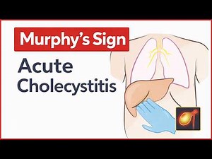 Murphy’s Sign | Acute Cholecystitis
