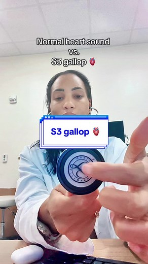 That extra “ta” you hear? 👂🏽 That’s the S3 a low-pitched sound in early diastole often linked to heart failure and volume overload. #cardiology #cardiologist #doctorsoftiktok #womeninmedicine #hearthealth