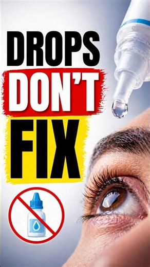 Eye Drops Won’t Fix Your Eye Problems… Here’s Why 👁️💧#shorts #viral #shortvideo #eyehealth #eyes