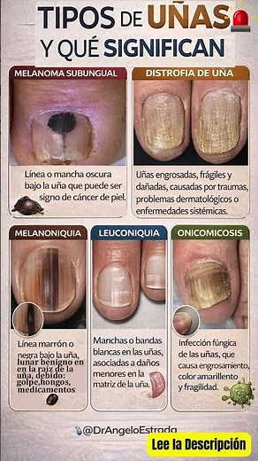 TIPOS DE UÑAS Y QUE SIGNIFICAN