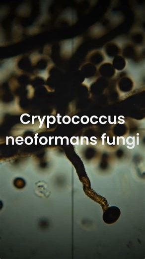 This Fungus Uses Radiation to Grow (Chernobyl)