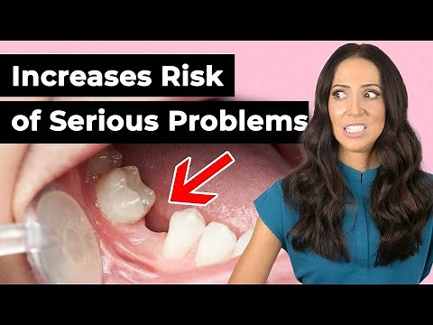 What Happens If You Don't Replace Your Missing Tooth?
