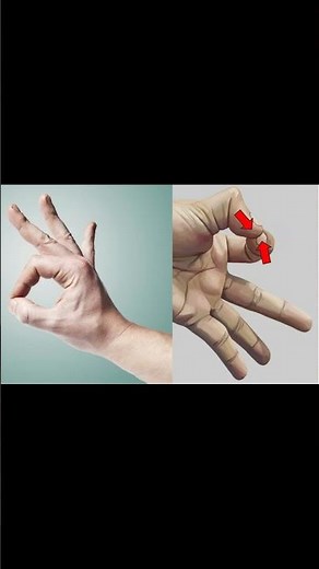 Jeanne’s Sign 👍 Ulnar Nerve Exam #neurology #elbowpain #ATC #anatomy #physio #ortho