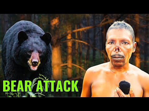 "Man's Face Attacked by Sloth Bear 3 Times – Survival!"