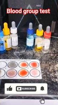 ABO & Rh Blood group test ❤️#bloodgroup #test