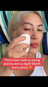 Besides getting my Botox I also use this!! My favorite 😍 | Thuy Hoang