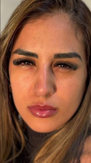 Botox: O antes e depois que você precisava ver! ✨ #botox #estetica #shorts