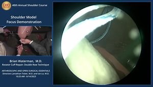 Shoulder Model Focus Demonstration - Rotator Cuff Repair: Double Row Technique