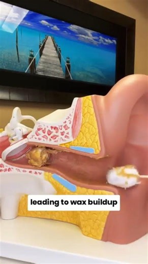 This Smart Ear Cleaner Lets You See Inside Your Ear