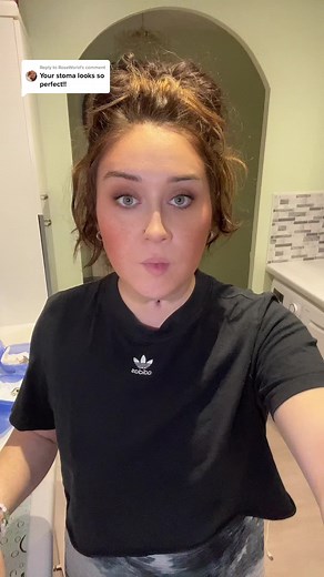 Tracheostomy Tube Change Process with Detailed Instructions