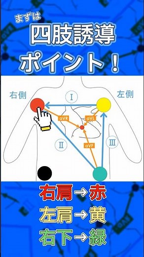 病棟ではじめての十二誘導心電図⚡️まずは...四肢誘導！part32 #心電図検定 #看護師 #心電図 #訪問看護師 #医学生