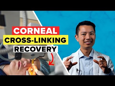 What to Expect During Your Corneal Cross-Linking Surgery?