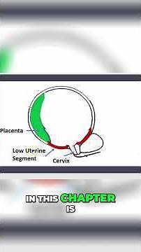 What is Placenta previa? I Medicine3minutes#shorts#placentaprevia#