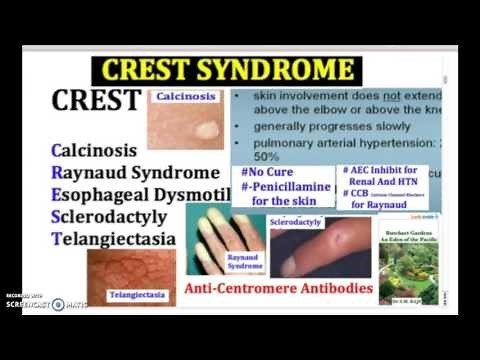 2-Minute: CREST Syndrome: Calcinosis, Raynaud, Sclerodactyly, Telangiectasia | USMLE & NCLEX