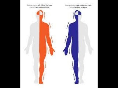BRUNNSTROM STAGES OF RECOVERY-VERY EASY