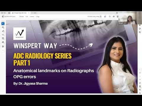 🦷 Radiology Made Easy – Part 1