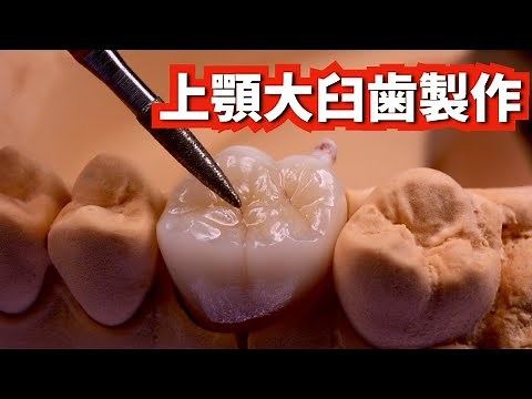 上顎第一大臼歯の作り方【Dental lab】