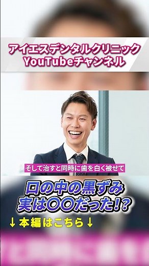歯茎が黒くなっている人、危ないかも⁉︎ #アイエスデンタルクリニック #歯医者 #審美治療