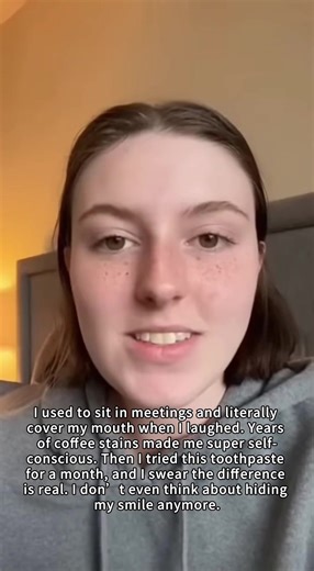 I used to hide my smile… until I tried this toothpaste for a month. The change is REAL#KUGIG #oralcare #whiteningteeth #teethcare #foryou