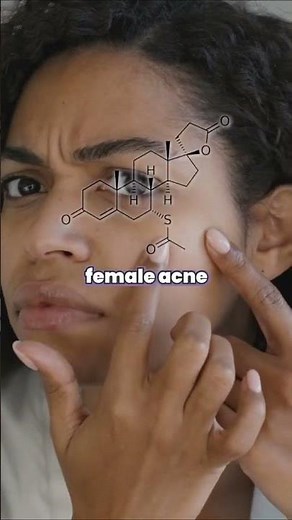 Spironolactone for Acne: Part I