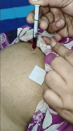 IM injection