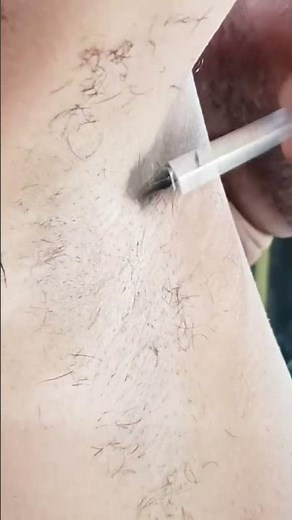 How to young man Arampit shave video only✂✂✂✂ 🪒🪒🪒🪒