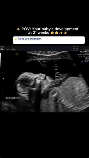 Your Baby's Development at 21 Weeks: What to Expect