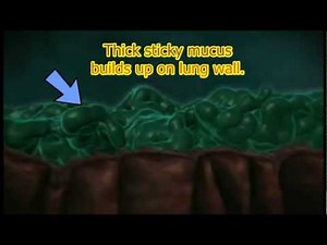 Defective CFTR: mucus build-up animation