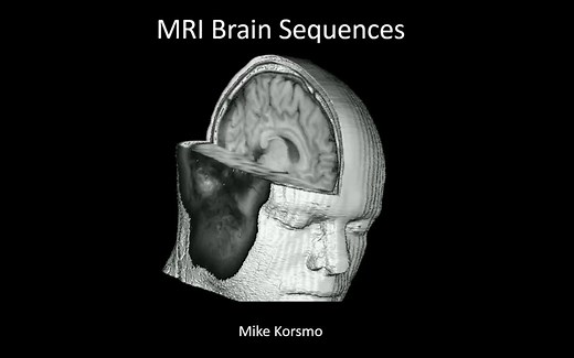 MRI, T1, T2, FLAIR, GRE, DWI