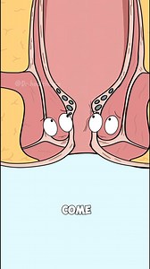 12M views · 65K reactions | Why Sitting Too Long on the Toilet Causes Hemorrhoids? | Darren Healthcare | Facebook