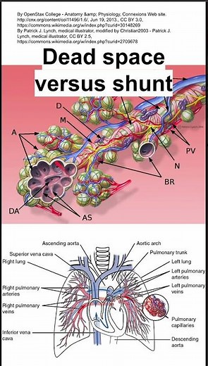 Dead space versus shunt