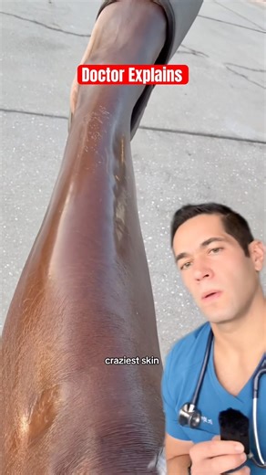 Why this smooth skin is a BAD sign