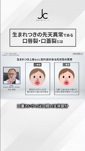 [Secondary Correction of Cleft Lip] What are Cleft Lip and Cleft Palate, congenital anomalies pre...
