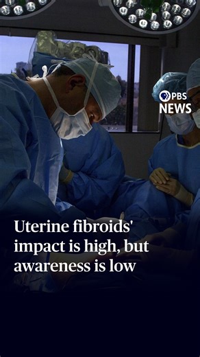 From unbearable pain to feeling no symptoms at all, women with uterine fibroids can have vastly different experiences. While these growths affect a large percentage of women, health advocates say they often go undiscussed. PBS News Weekend's Ali Rogin spoke to The Fibroid Foundation's Sateria Venable to learn more. | PBS NewsHour