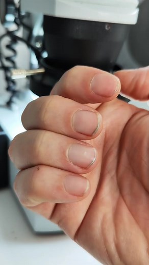 Genius Technology | 😱 You won't believe what's hiding under your fingernails! 🦠🦠🦠 I took a close look at my dirty fingernails under the microscope, and I was... | Instagram