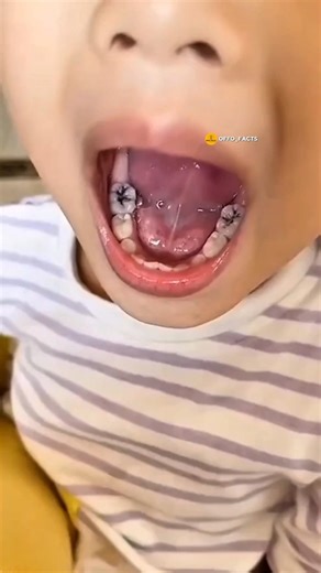 Top secret Amazing kitchen Hacks 🍵 😱| Mind Blowing Hacks In Hindi | Random Facts #facts #shorts