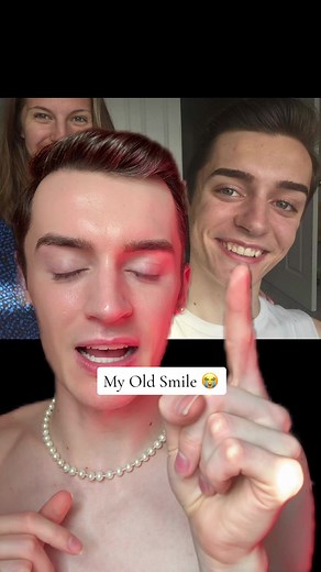 Before and After Braces Transformation - My Dental Journey