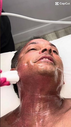 Lower Face and Neck Treatment for Men with Venus Legacy™