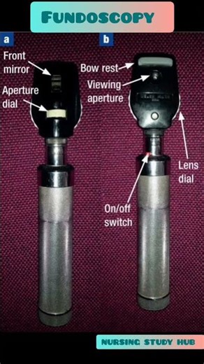 Fundoscopy #shortsfeed #ytshortsindia #viralvideos