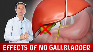 6 Tips for Living Without a Gallbladder | Dr. Berg