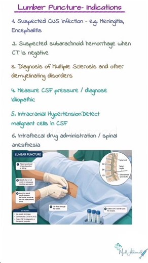 Indications of Lumbar Puncture | ICU Basics