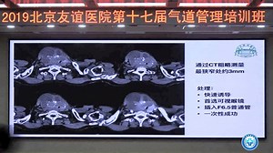 如何理解Vortex在困难气道管理中的应用